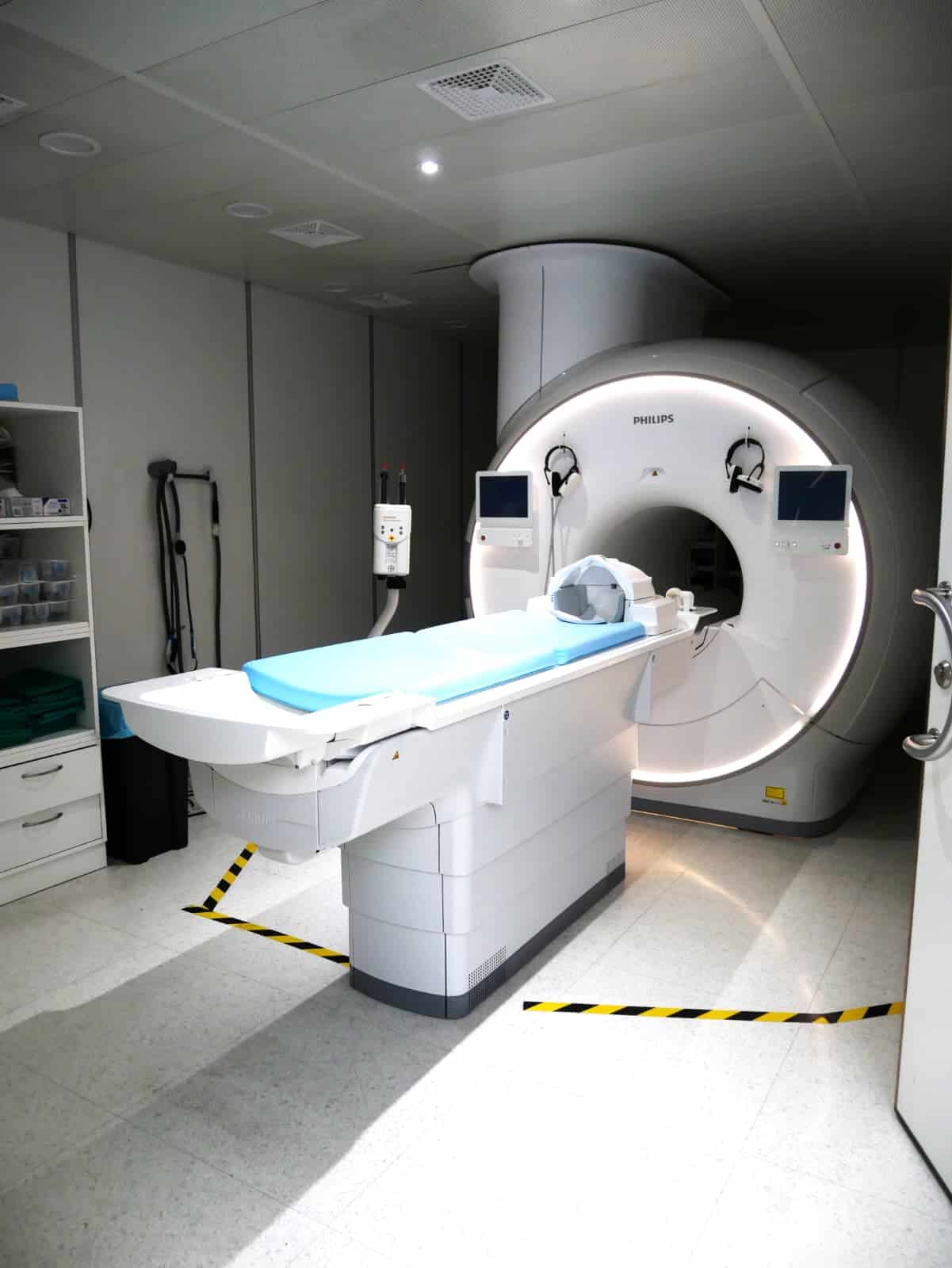 Molinette, nuova risonanza magnetica 3 Tesla: esami più rapidi e ricerca sulle malattie del cervello